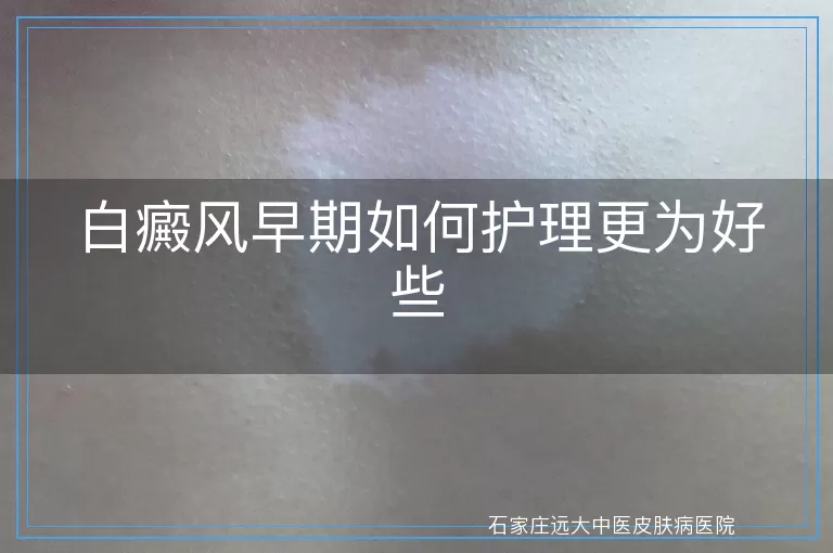 白癜风早期如何护理更为好些