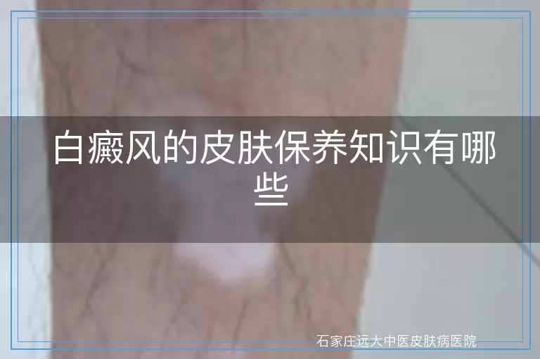 白癜风的皮肤保养知识有哪些