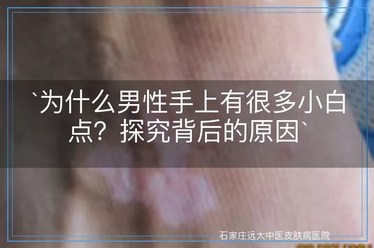 `为什么男性手上有很多小白点？探究背后的原因`