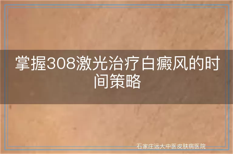 掌握308激光治疗白癜风的时间策略