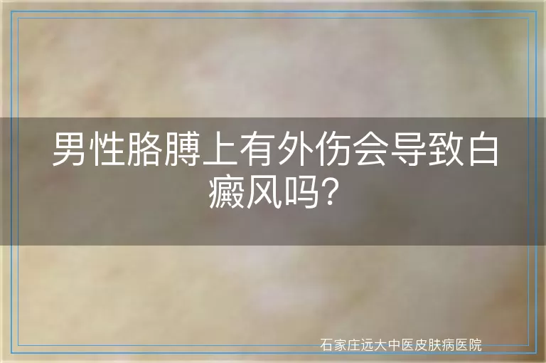 男性胳膊上有外伤会导致白癜风吗？