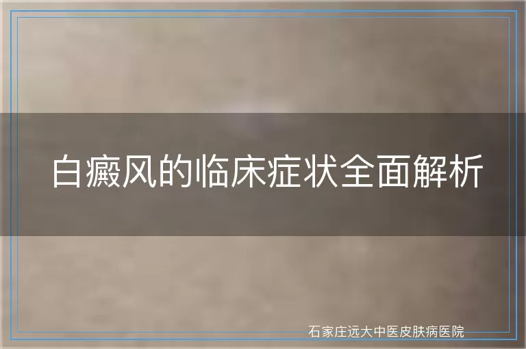 白癜风的临床症状全面解析