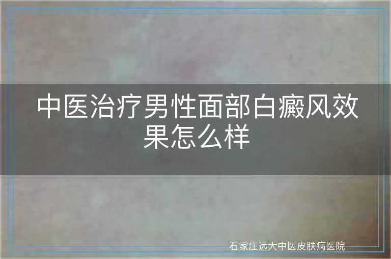 中医治疗男性面部白癜风效果怎么样