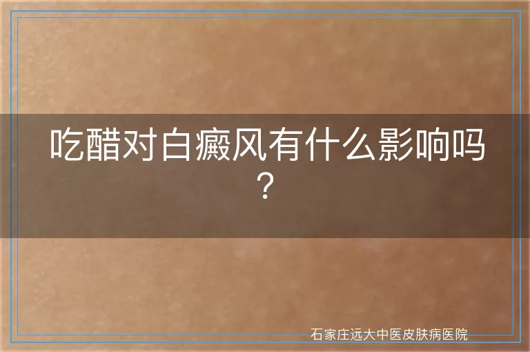 吃醋对白癜风有什么影响吗？