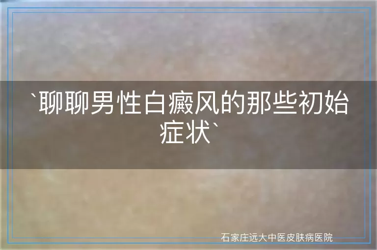 聊聊男性白癜风的那些初始症状