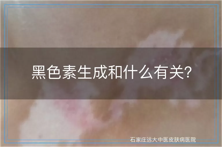 黑色素生成和什么有关？