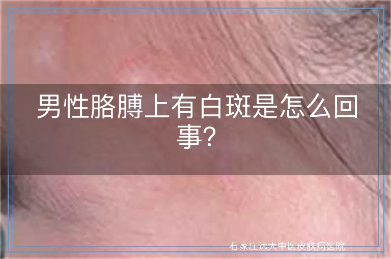 男性胳膊上有白斑是怎么回事？