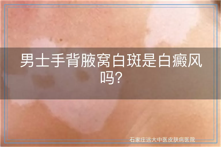 男士手背腋窝白斑是白癜风吗？