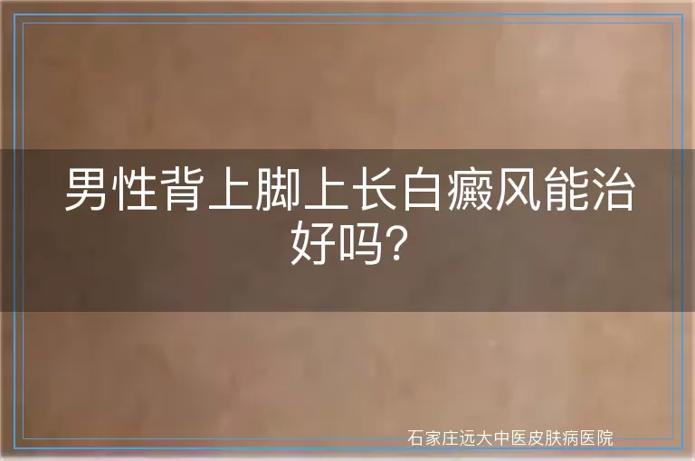 男性背上脚上长白癜风能治好吗？