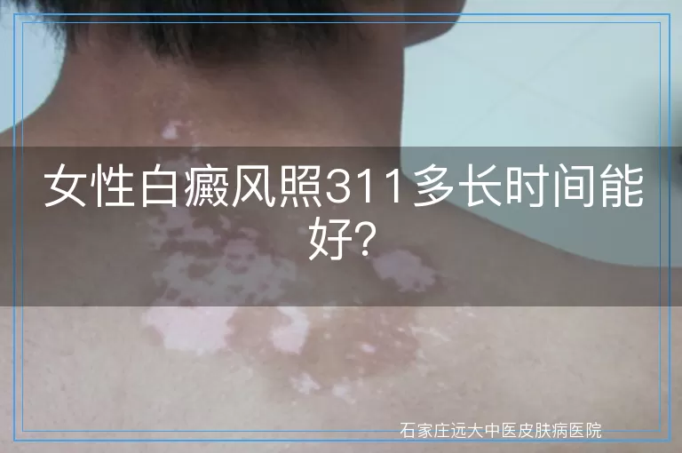 女性白癜风照311多长时间能好？