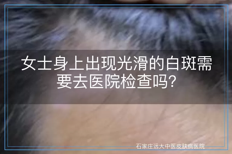 女士身上出现光滑的白斑需要去医院检查吗？