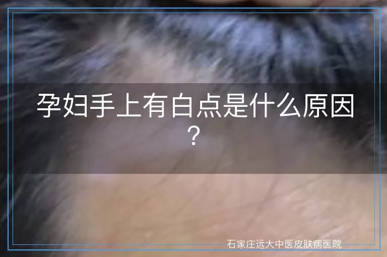 孕妇手上有白点是什么原因？