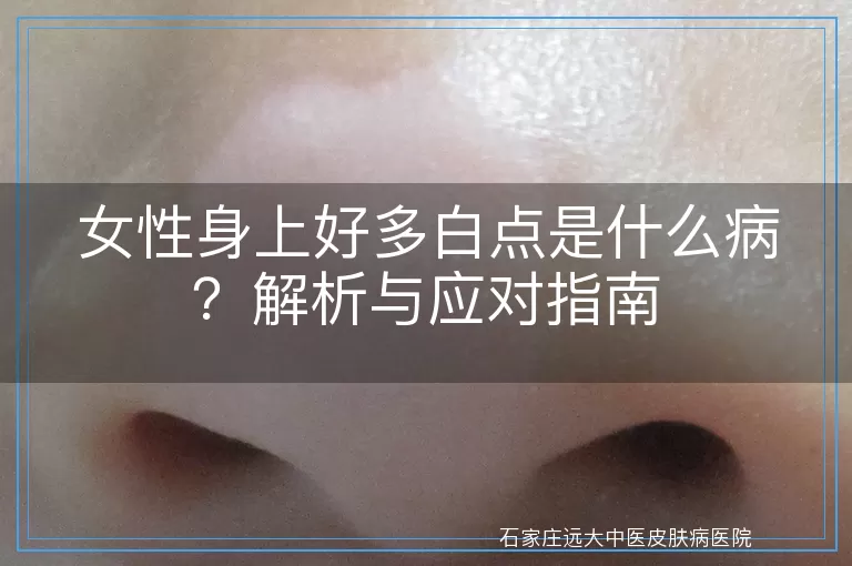 女性身上好多白点是什么病？解析与应对指南