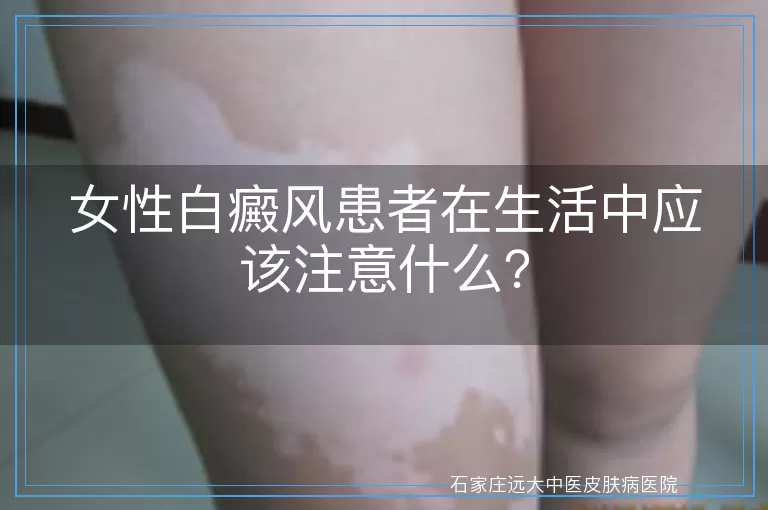 女性白癜风患者在生活中应该注意什么？