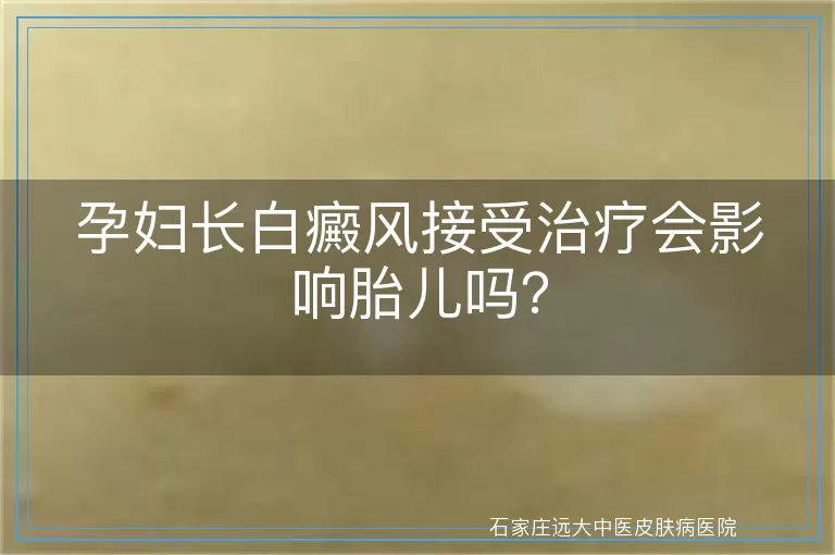 孕妇长白癜风接受治疗会影响胎儿吗？