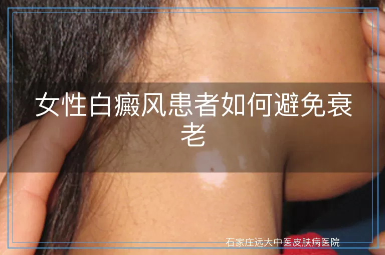 女性白癜风患者如何避免衰老