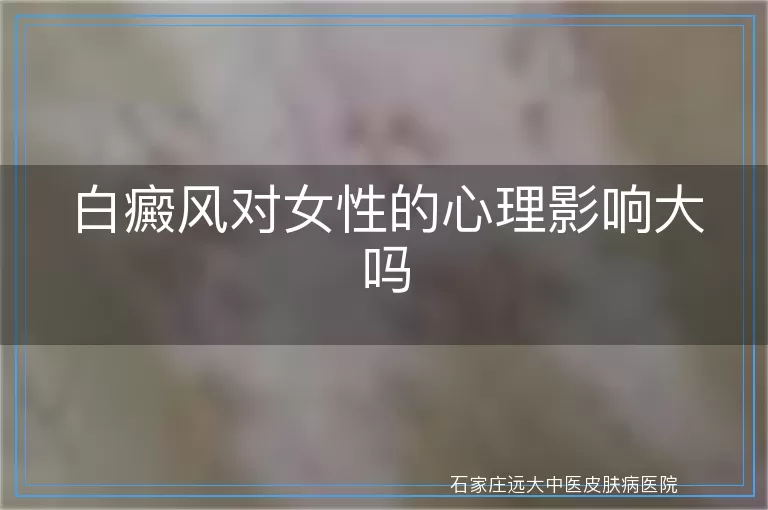 白癜风对女性的心理影响大吗