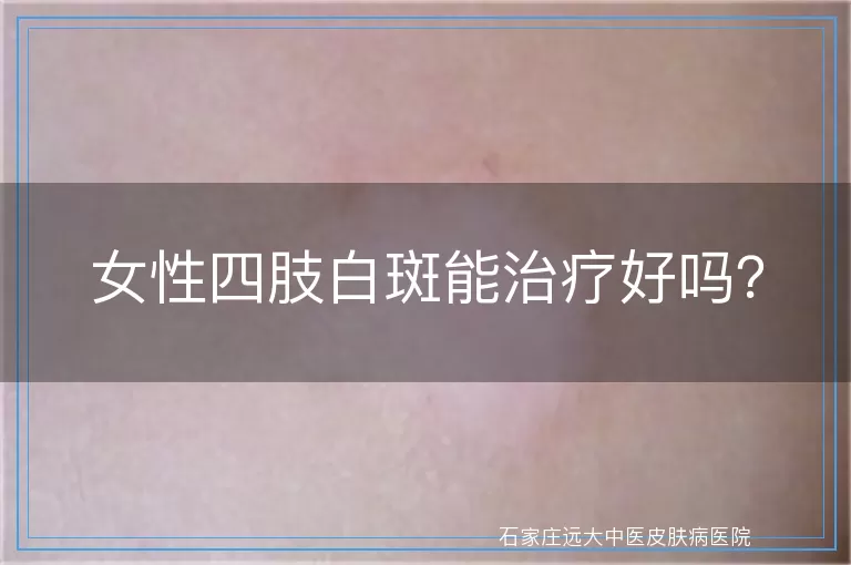 女性四肢白斑能治疗好吗？