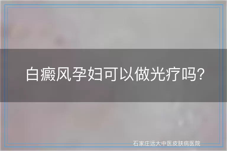 白癜风孕妇可以做光疗吗？