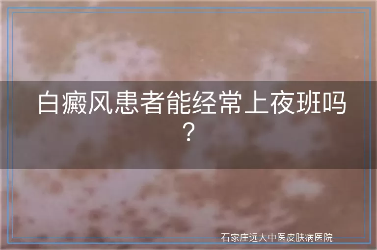 白癜风患者能经常上夜班吗？