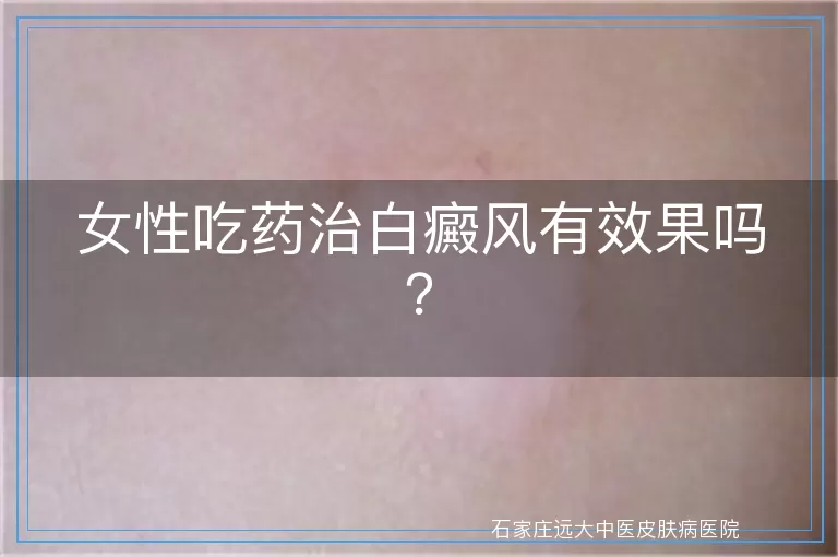 女性吃药治白癜风有效果吗？