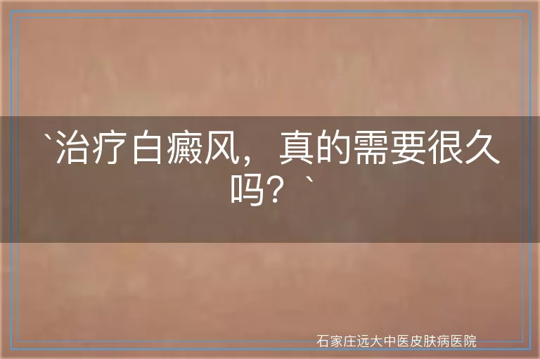 `治疗白癜风，真的需要很久吗？`