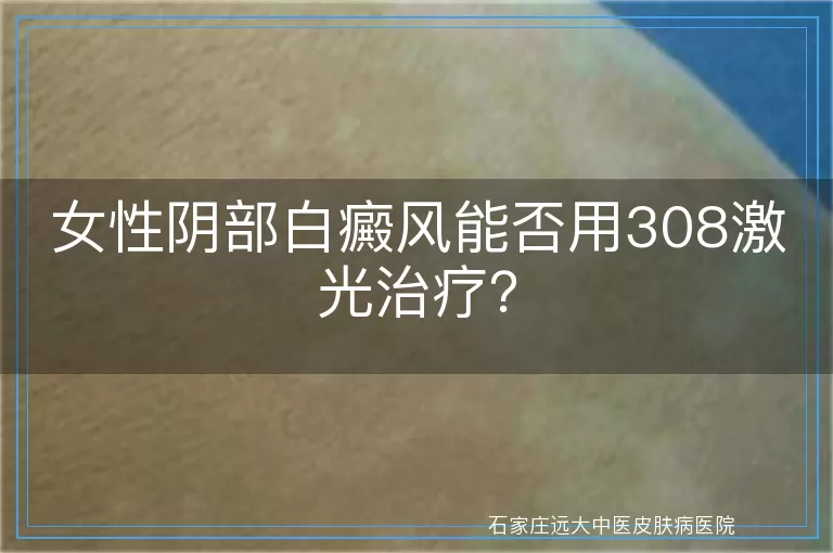 女性阴部白癜风能否用308激光治疗？