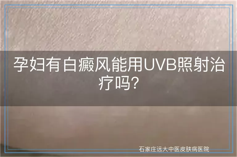 孕妇有白癜风能用UVB照射治疗吗？