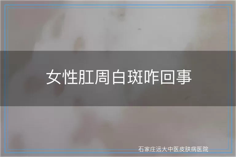 女性肛周白斑咋回事