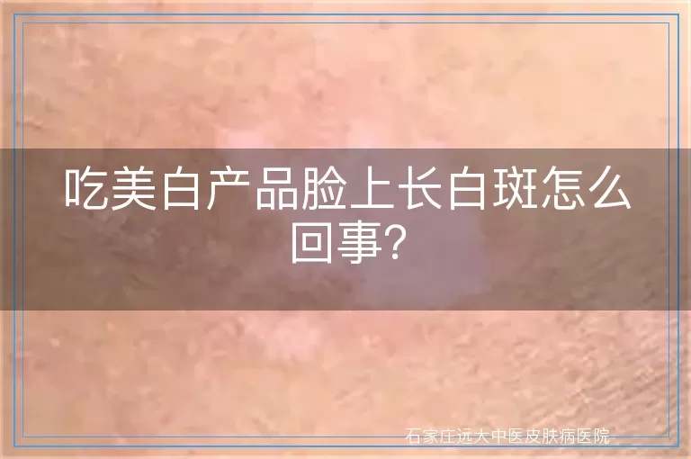 吃美白产品脸上长白斑怎么回事？