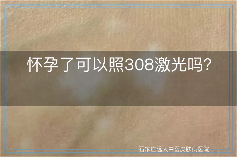 怀孕了可以照308激光吗？