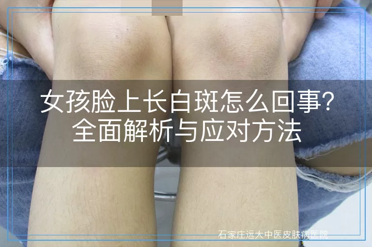 女孩脸上长白斑怎么回事？全面解析与应对方法