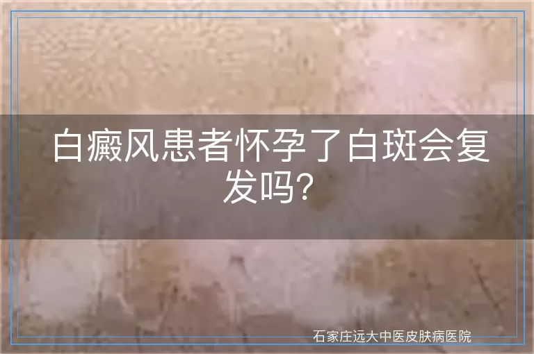 白癜风患者怀孕了白斑会复发吗？