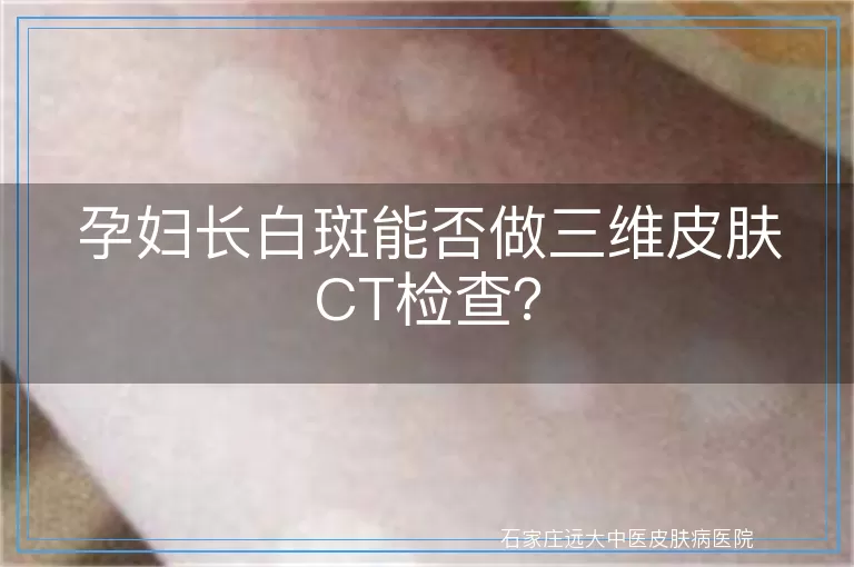 孕妇长白斑能否做三维皮肤CT检查？