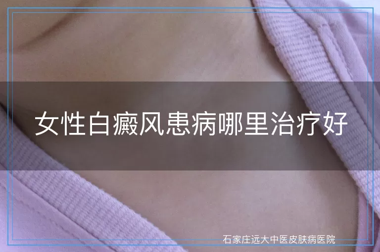 女性白癜风患病哪里治疗好