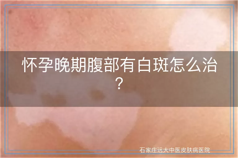 怀孕晚期腹部有白斑怎么治？