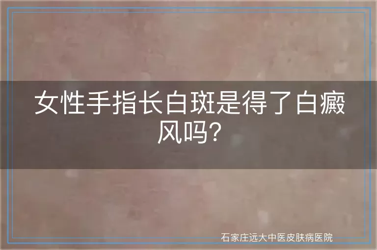 女性手指长白斑是得了白癜风吗？