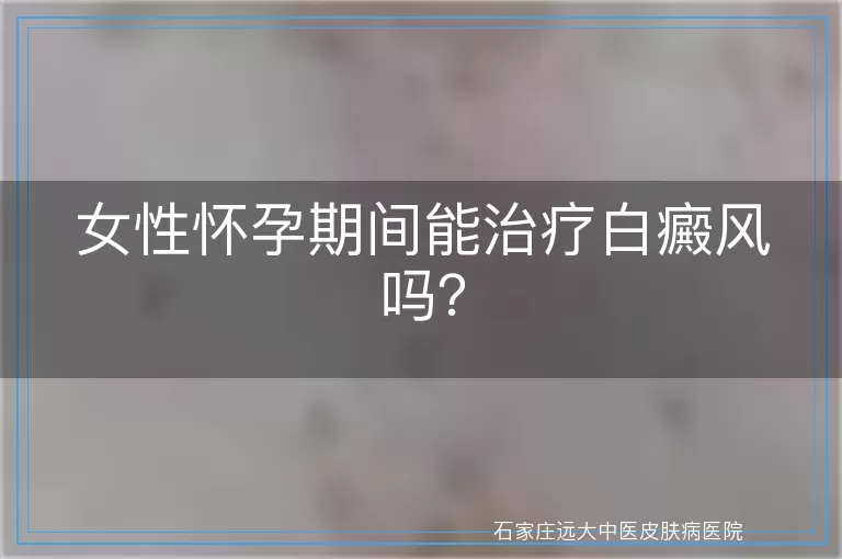 女性怀孕期间能治疗白癜风吗？