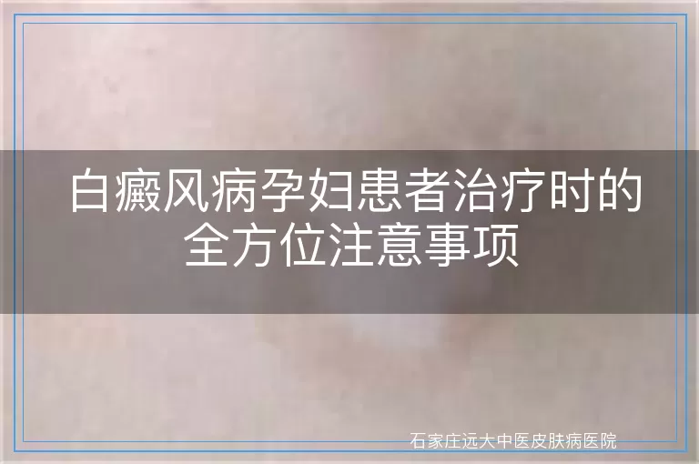 白癜风病孕妇患者治疗时的全方位注意事项