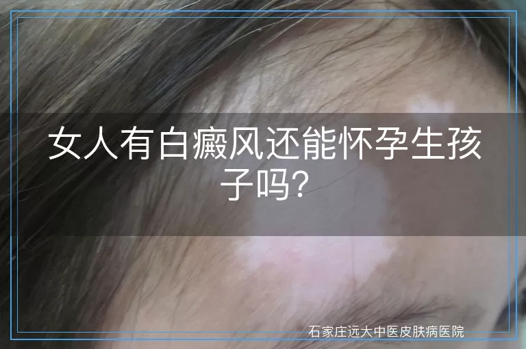 女人有白癜风还能怀孕生孩子吗？