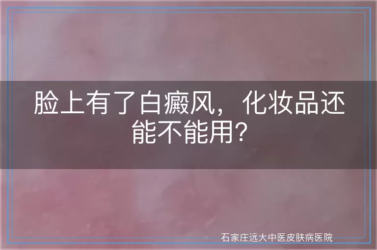 脸上有了白癜风，化妆品还能不能用？