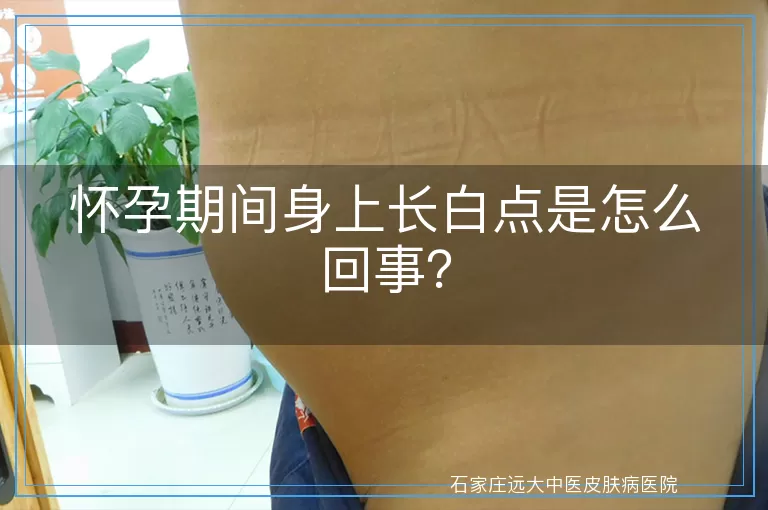 怀孕期间身上长白点是怎么回事？