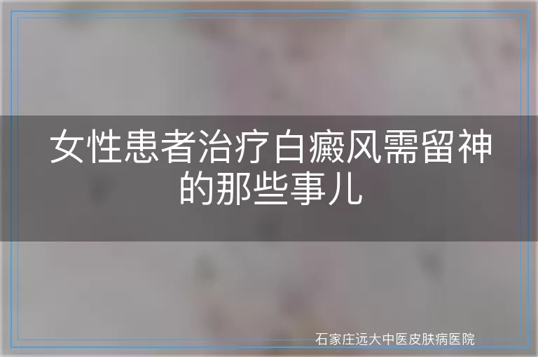 女性患者治疗白癜风需留神的那些事儿