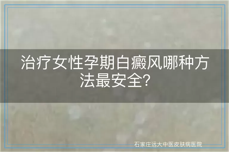 治疗女性孕期白癜风哪种方法最安全？