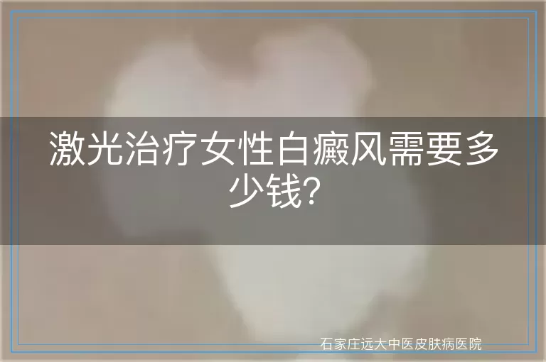 激光治疗女性白癜风需要多少钱？