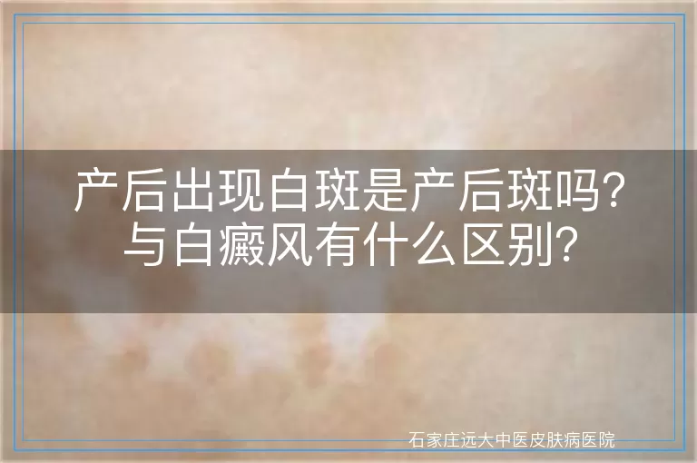 产后出现白斑是产后斑吗？与白癜风有什么区别？