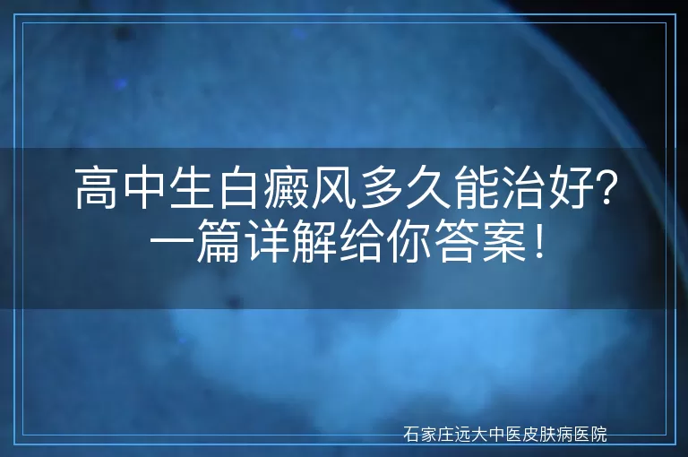 高中生白癜风多久能治好？一篇详解给你答案！