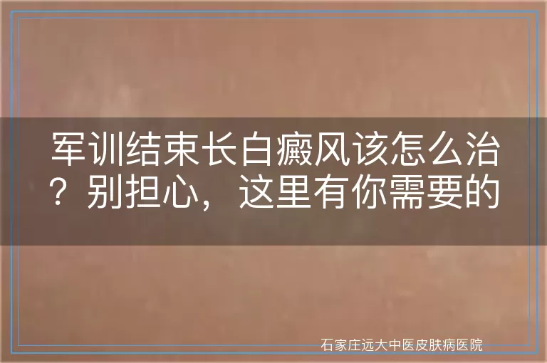 军训结束长白癜风该怎么治？别担心，这里有你需要的答案！