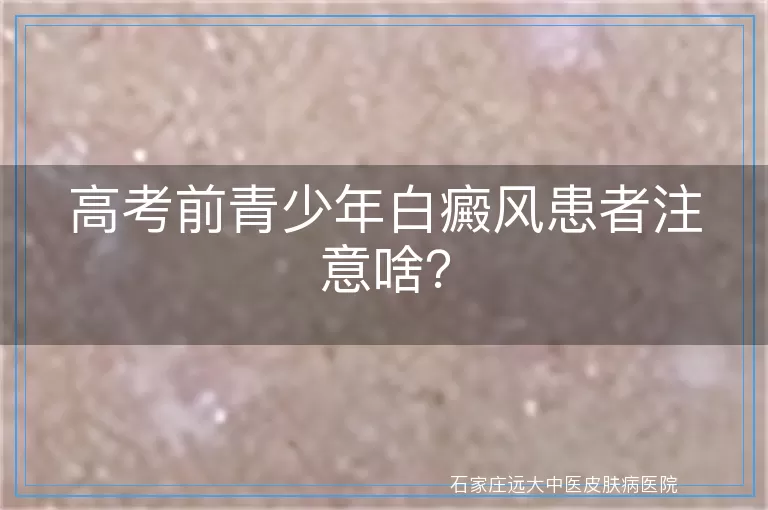 高考前青少年白癜风患者注意啥？