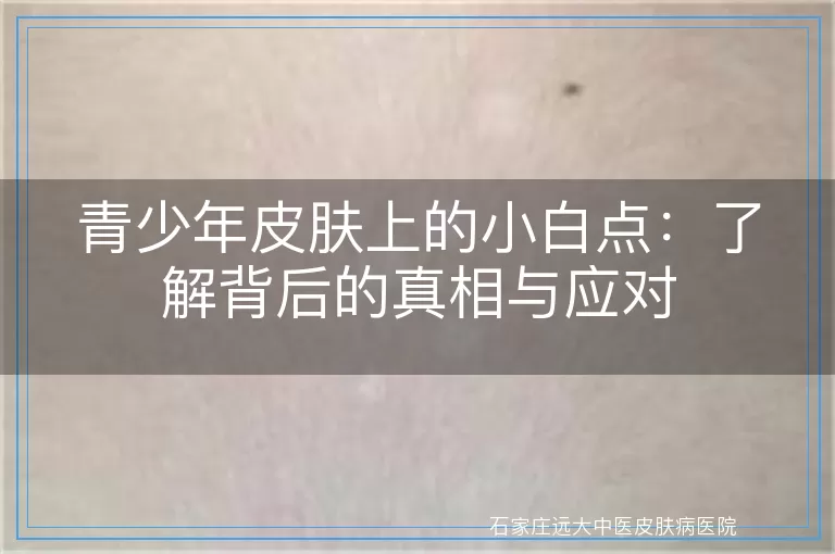 青少年皮肤上的小白点：了解背后的真相与应对